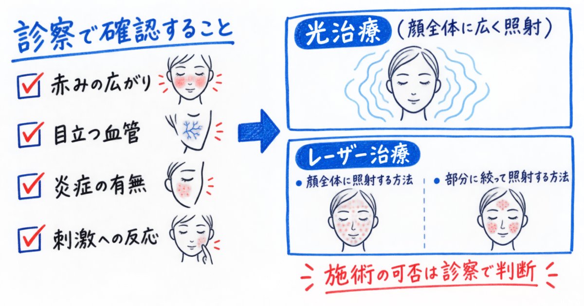IPL(ICON)とエクセルV+は何を診て選ぶ?